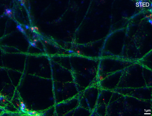 STED